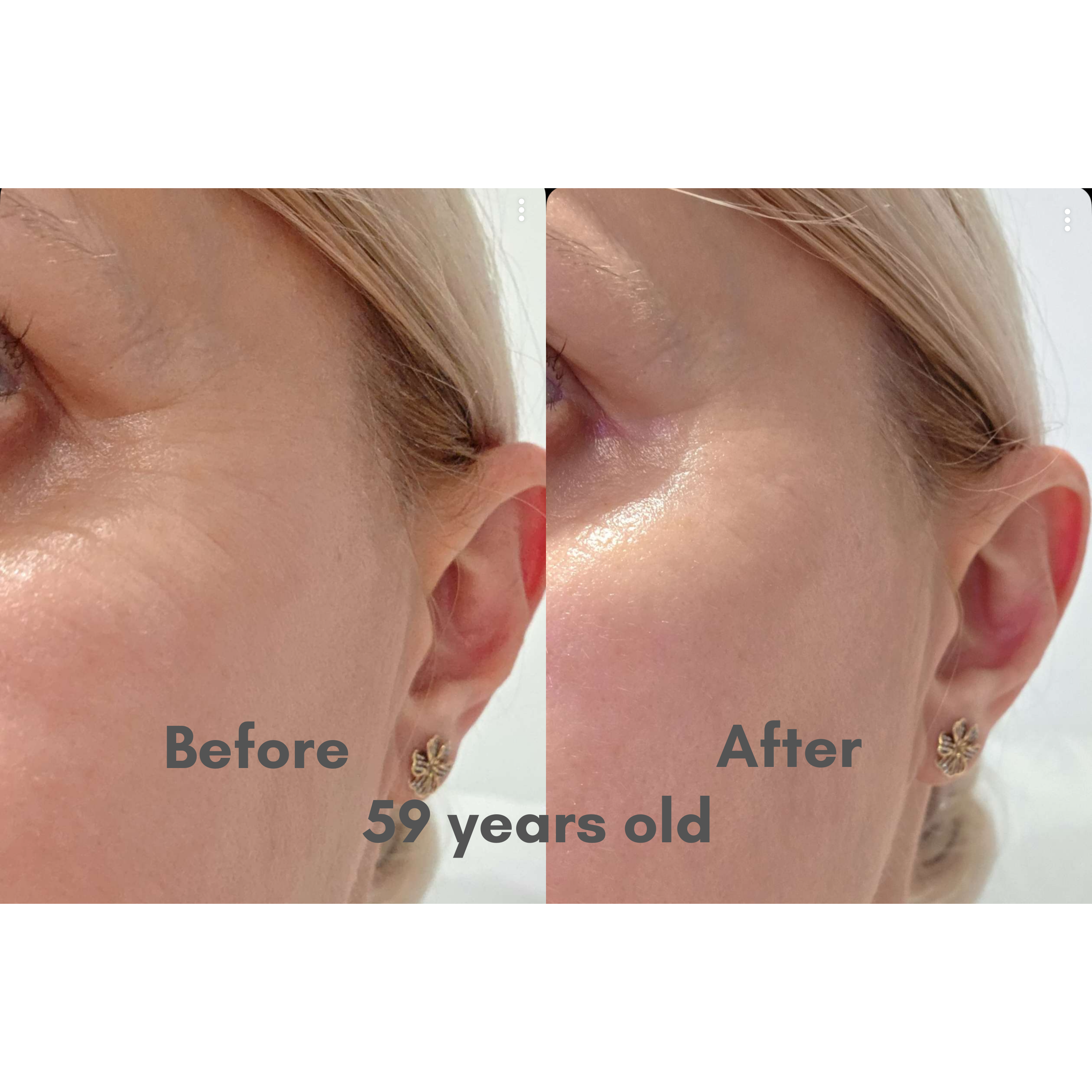 Youth 46 Cream- Tri Peptide Bounce